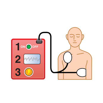 Aufbau eines Defibrillators