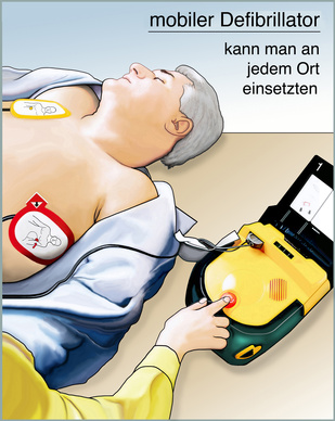 Wie funktioniert ein Defibrillator?